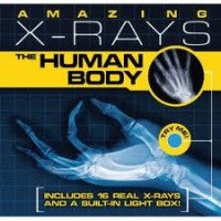 Image of Amazing X-Rays: The Human Body